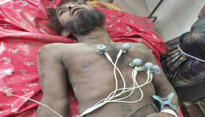 ​চাঁপাইনবাবগঞ্জে গরু চুরিতে গণপিটুনির শিকার যুবকের মৃত্যু