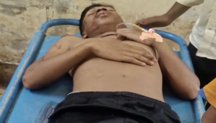 ​বেনাপোলে যুবককে লক্ষ্য করে গুলি, অল্পের জন্য প্রাণে রক্ষা