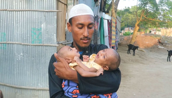 দারিদ্র্যে আটকে আছে জয়নব ও উম্মে কুলসুমের নতুন জীবনের স্বপ্ন