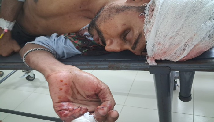 ​গোপালগঞ্জের সন্ত্রাসী অন্তর বাহিনির হামলায় যুবক গুরুতর আহত